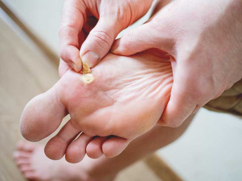 A man holding his leg